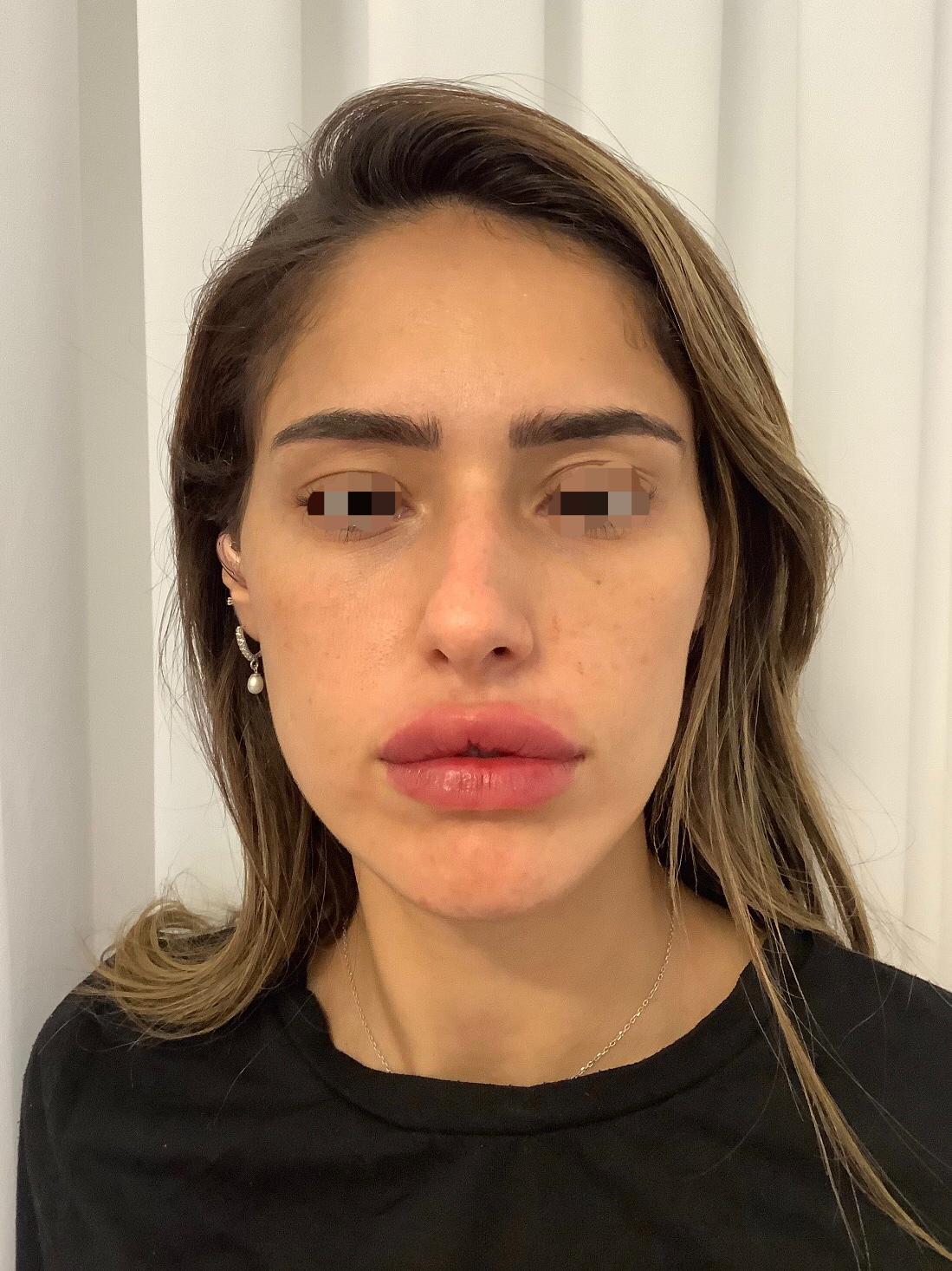 אחרי שפתיים