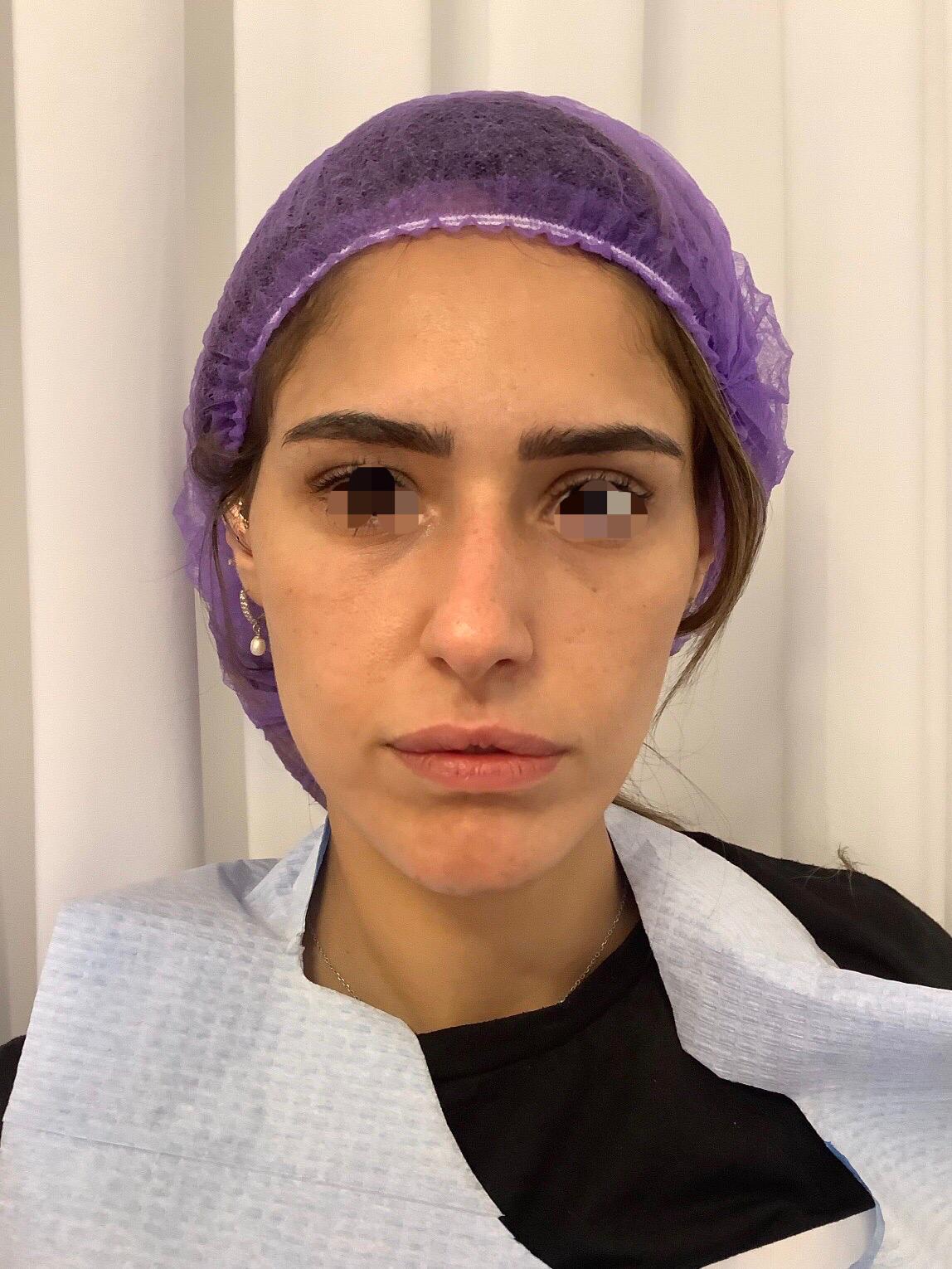 לפני שפתיים