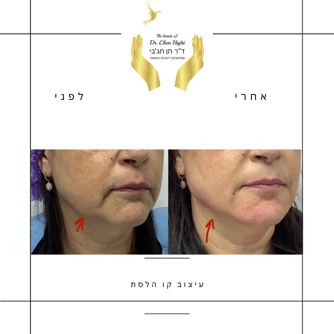 WhatsApp Image 2021-01-11 at 18.29.32