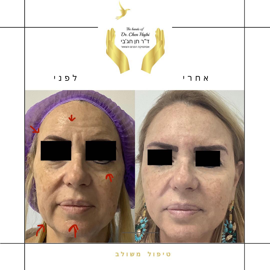 WhatsApp Image 2021-01-18 at 19.49.56